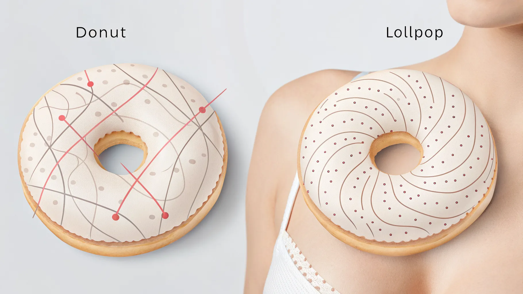 A Guide to Areola Reduction Procedure Types