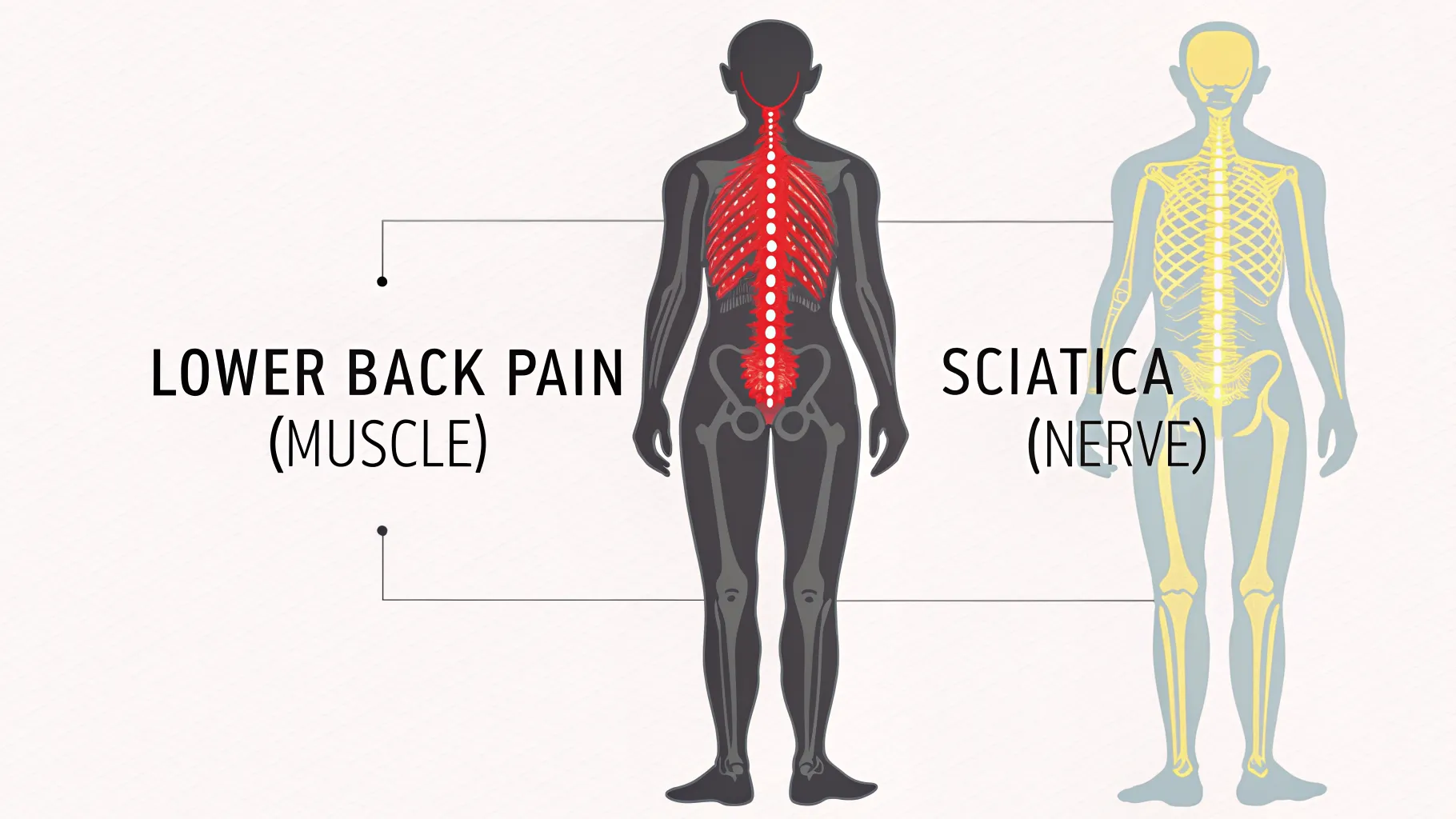 Lower Back Pain vs. Sciatica: Understanding the Key Differences
